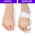 CORRECTOR DE JUANETES ELIMINA DOLOR EN PIES